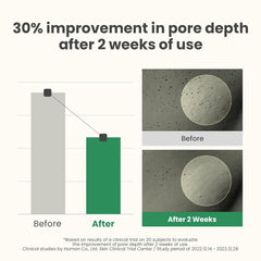 AXIS - Y - LHA Peel&Fill Pore Balancing Cream