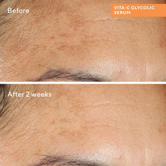 Murad Vitamin C Starter Kit