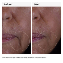 THE ORDINARY GF Solution 15% Serum