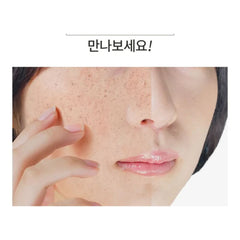 Anua - Vitamin C Blemish Serum Mask