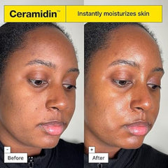 Dr. Jart+ - Ceramidin Skin Barrier Moisturizing Cream
