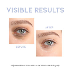 OOTD - Intensive Eye Serum A.M 30g