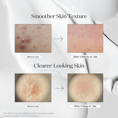 VT - Reedle Shot 100 Mini