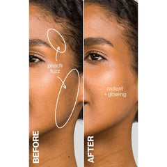 DERMAFLASH LUXE 1 Kit (Various Colours)