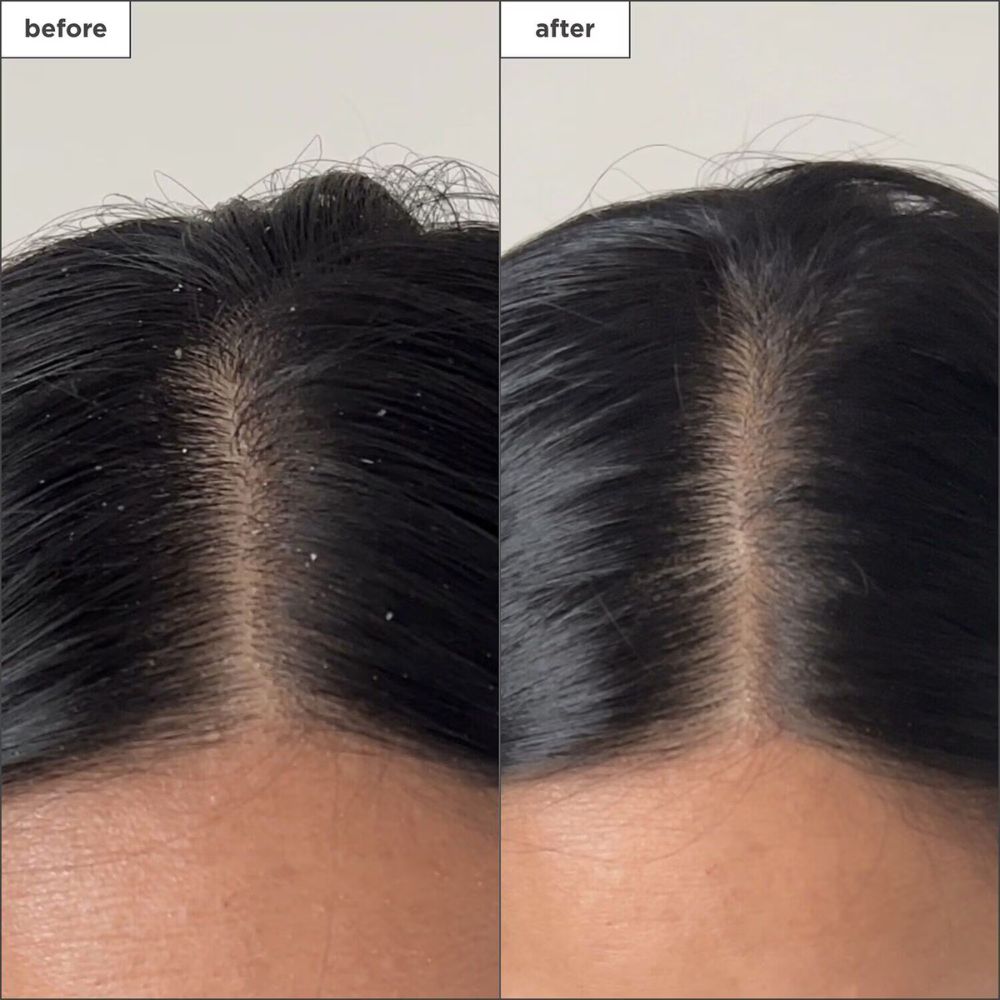 BRIOGEO Scalp Revival™ Charcoal + Tea Tree Buildup Detox Spray