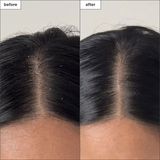 BRIOGEO Scalp Revival™ Charcoal + Tea Tree Buildup Detox Spray