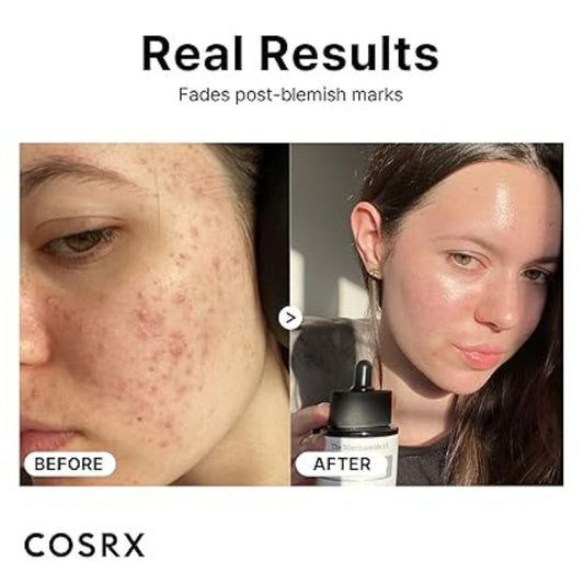 COSRX - The Niacinamide 15 Serum