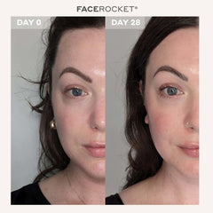 MAGNITONE London GetLit LED Face Mask with FaceRocket Firming and Toning Device Bundle