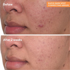 Murad Daily Illuminators Set