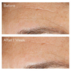 Murad Vita-C Glycolic Serum Deluxe Travel Size 15ml