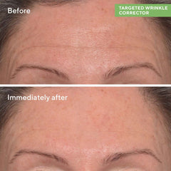 Murad Targeted Wrinkle Corrector 15ml