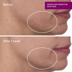 Murad Sensitive Skin Heartleaf Calming Cream 50ml