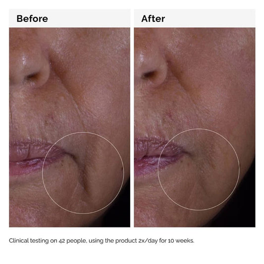 THE ORDINARY GF Solution 15% Serum