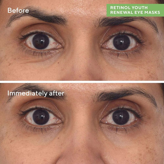 Murad Retinol Youth Renewal Eye Masks (5 Pack)