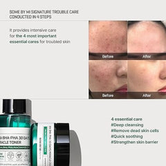 SOME BY MI - AHA, BHA, PHA 30 Days Miracle Starter Limited Set