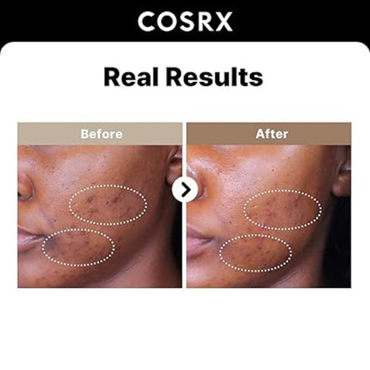 COSRX - The Alpha-Arbutin 2 Discoloration Care Serum