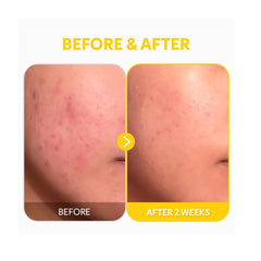 TIRTIR - Pure Vitamin C24 Serum