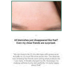 SOME BY MI - AHA, BHA, PHA 30 Days Miracle Cleansing Bar 1pc